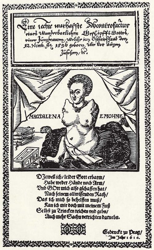 Prager Meister von 1616: Missgeburt einer jungen Frau bei Emden im Jahre 1596