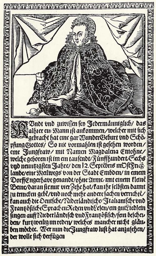 Deutscher Meister des 17. Jahrhunderts: Missgeburt einer Frau bei Emden im Jahre 1596