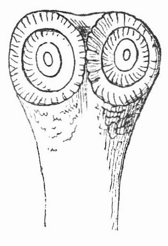 Fig. 5. Kopf von T. saginata. Vergr.