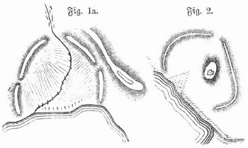 Fig. 1a. Grundri des Rundwalles am Hadeby Nor. Fig. 2. Grundri des Rundwalles (mit Burganlage in der Mitte) von Pedersborg auf Seeland.