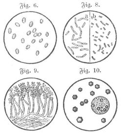 Fig. 6. Krperchen 60 0/1. Fig. 8. a Bakterien, b Mikrokkus der schlaffschtigen Raupe. 60 0/1. Fig. 9. Pilz der Kalksucht (Botrytis Bassiana). 20 0/1. Fig. 10. Polyedrische Krnchen der Gelb- oder Fettsucht.