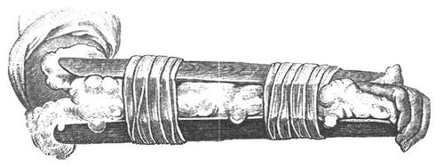 Fig. 11. Schienenverband bei Knochenbruch.